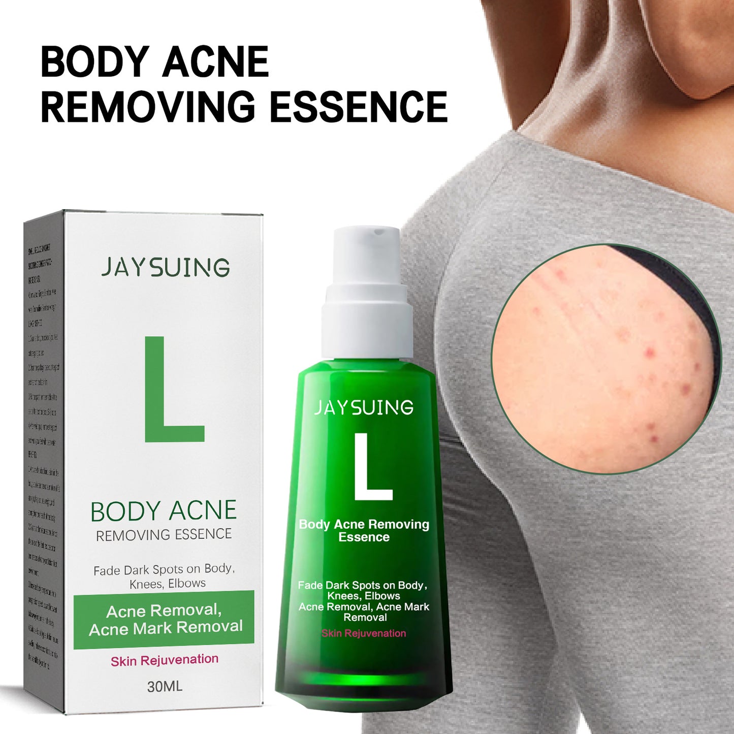 Jaysuing Acne Spot Lightening Serum for Skin Care